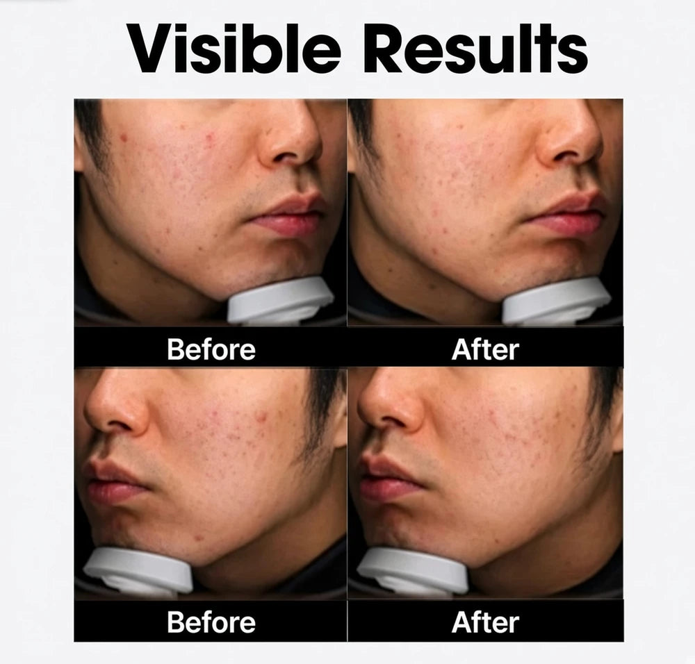 SOME BY MI AHA BHA PHA 30 Days Miracle Cream